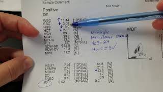 Hematology How to interpret automated Complete Blood Count CBC results [upl. by Niven290]