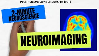 2Minute Neuroscience Neuroimaging [upl. by Costanzia]