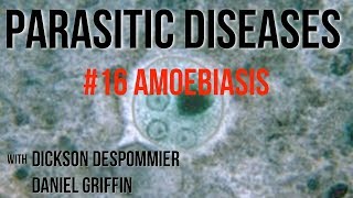 Parasitic Diseases Lectures 16 Amoebiasis [upl. by Hester]