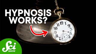 Can Hypnosis Permanently Change Your Brain [upl. by Kalli748]