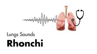 Rhonchi  Lung Sounds  Medzcool [upl. by Rise]