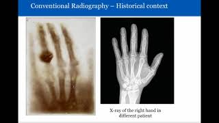 Introduction to Radiology Conventional Radiography [upl. by Llednohs]