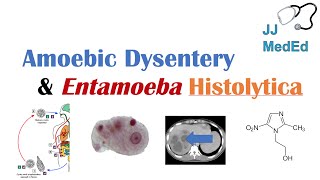 Amebiasis Amoebic Dysentery  Entamoeba histolytica Pathogenesis Signs amp Symptoms Treatment [upl. by Izak]